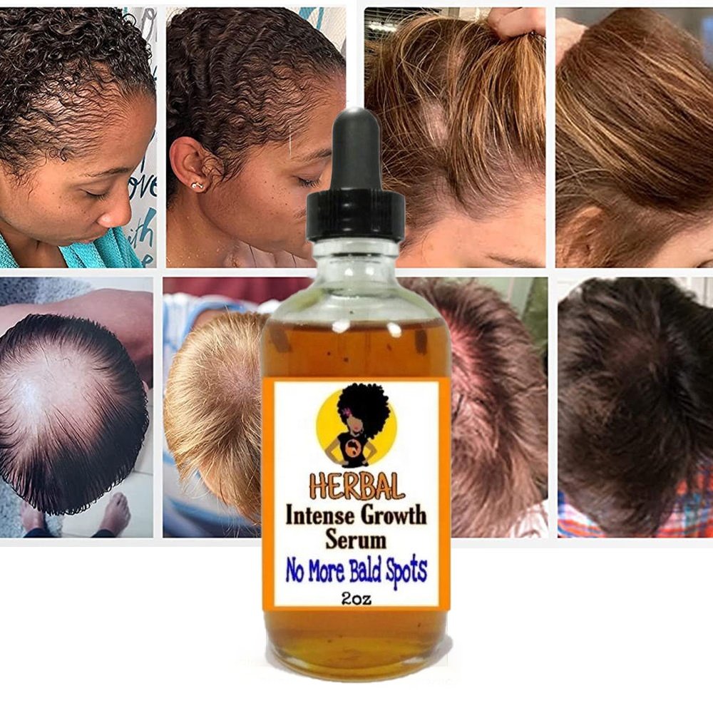 New Arrival Smoothing Repairing Anti Loss Hair Oil Regrowth Scalp Elixirs Private Label Hair Growth Oil Serum