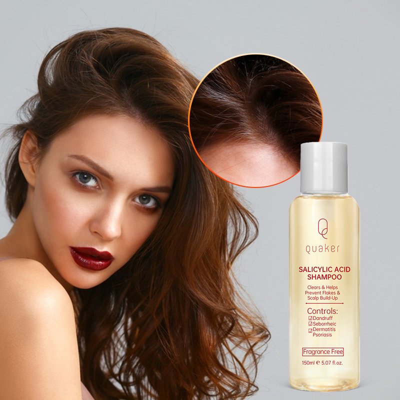 Qquaker Paraben Free Sulfate Free Prevent Hair Loss Anti Dandruff Shampoo And Conditioner Private Label Wholesale Shampoo