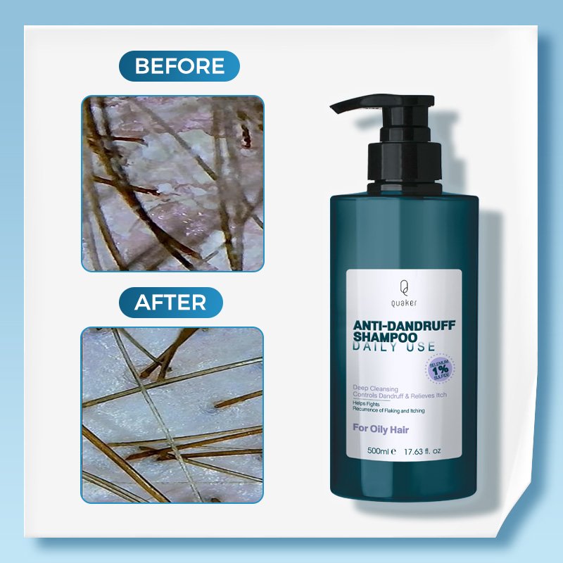 Qquaker Paraben Free Sulfate Free Prevent Hair Loss Anti Dandruff Shampoo And Conditioner Private Label Wholesale Shampoo