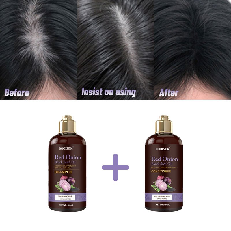 Dooisek 100% safe organic and paraben free hair treatment red onion shampoo for hair growth