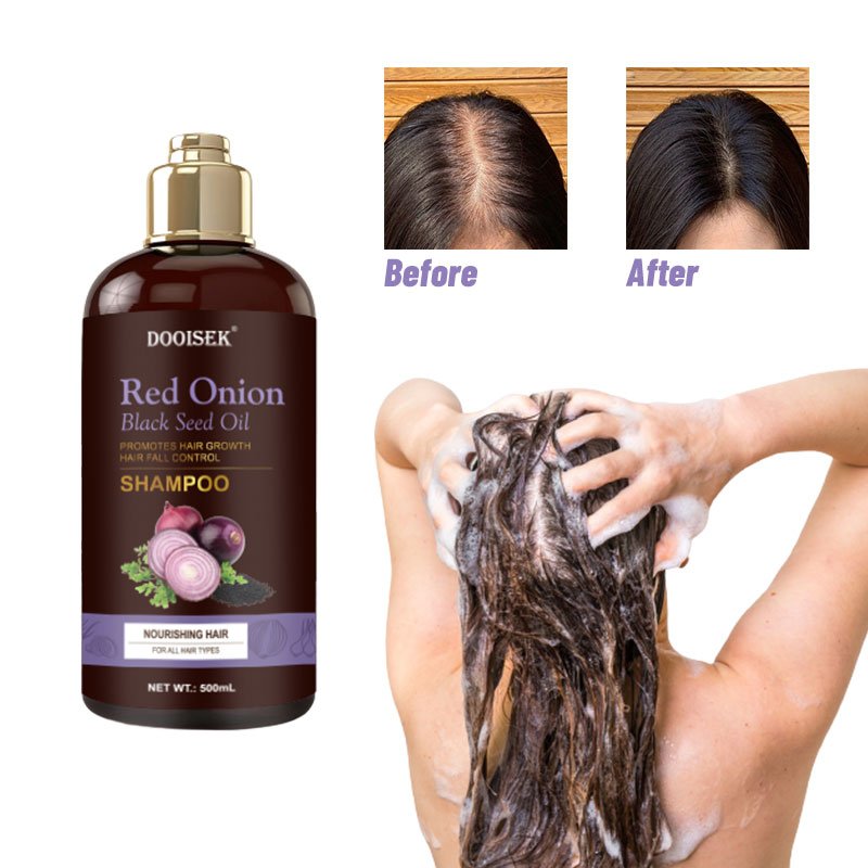 Dooisek 100% safe organic and paraben free hair treatment red onion shampoo for hair growth