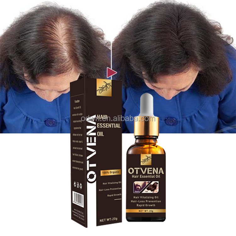 World Best Hair Regrowth Product Hair Care Regrowth Tonics