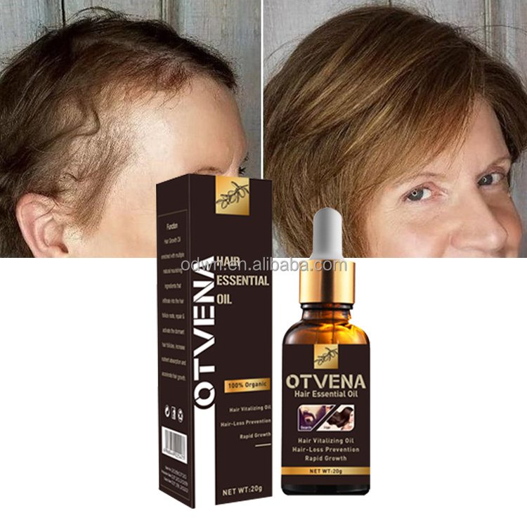 World Best Hair Regrowth Product Hair Care Regrowth Tonics