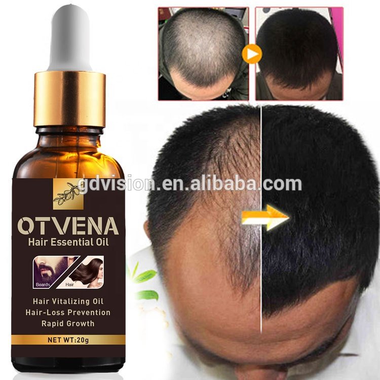 World Best Hair Regrowth Product Hair Care Regrowth Tonics