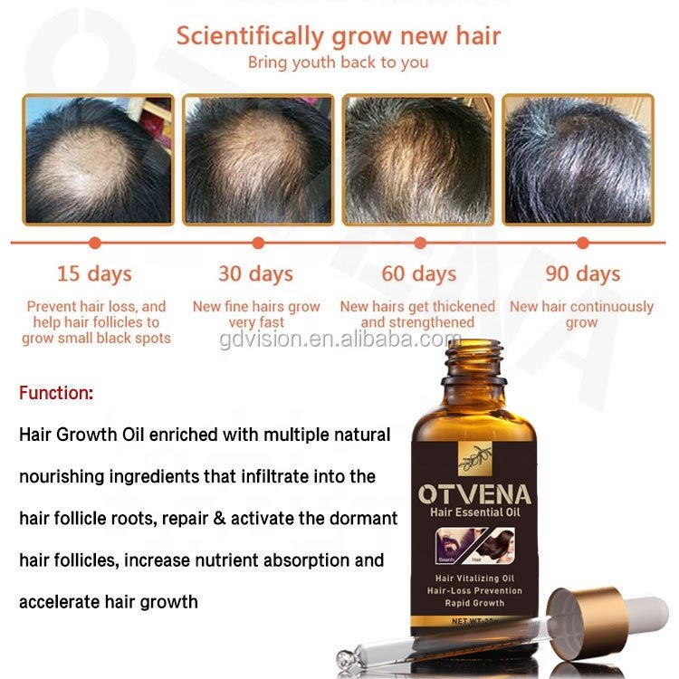 World Best Hair Regrowth Product Hair Care Regrowth Tonics