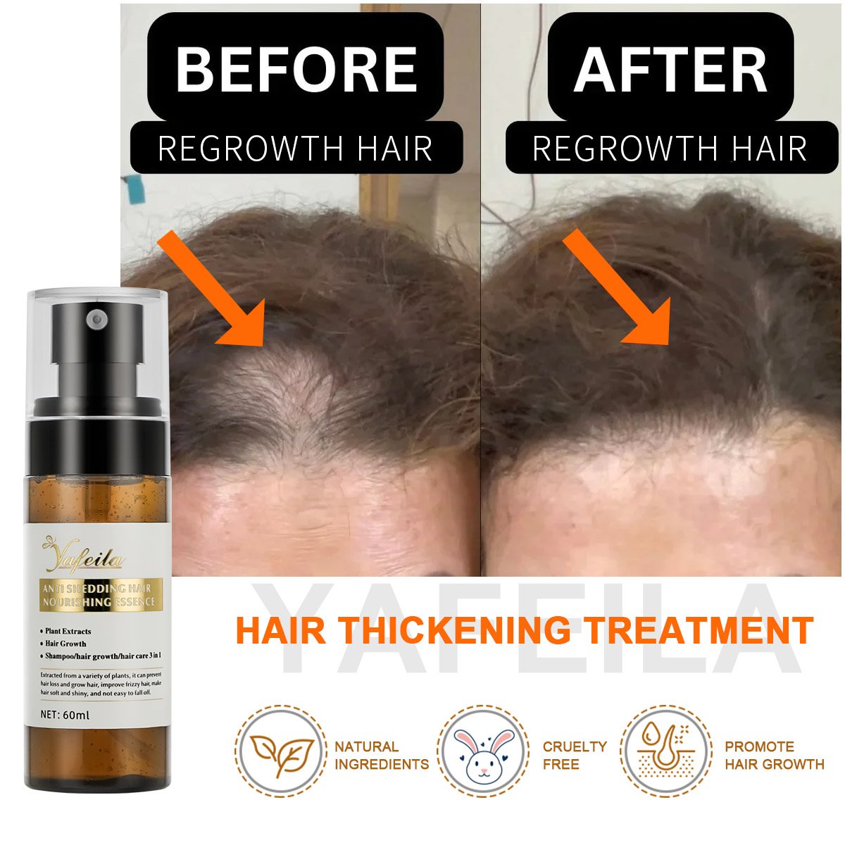 low moq 60ml anti hair fall spray Regrowth Spray with castor oil and vitamin E ingredients hair growth tonic
