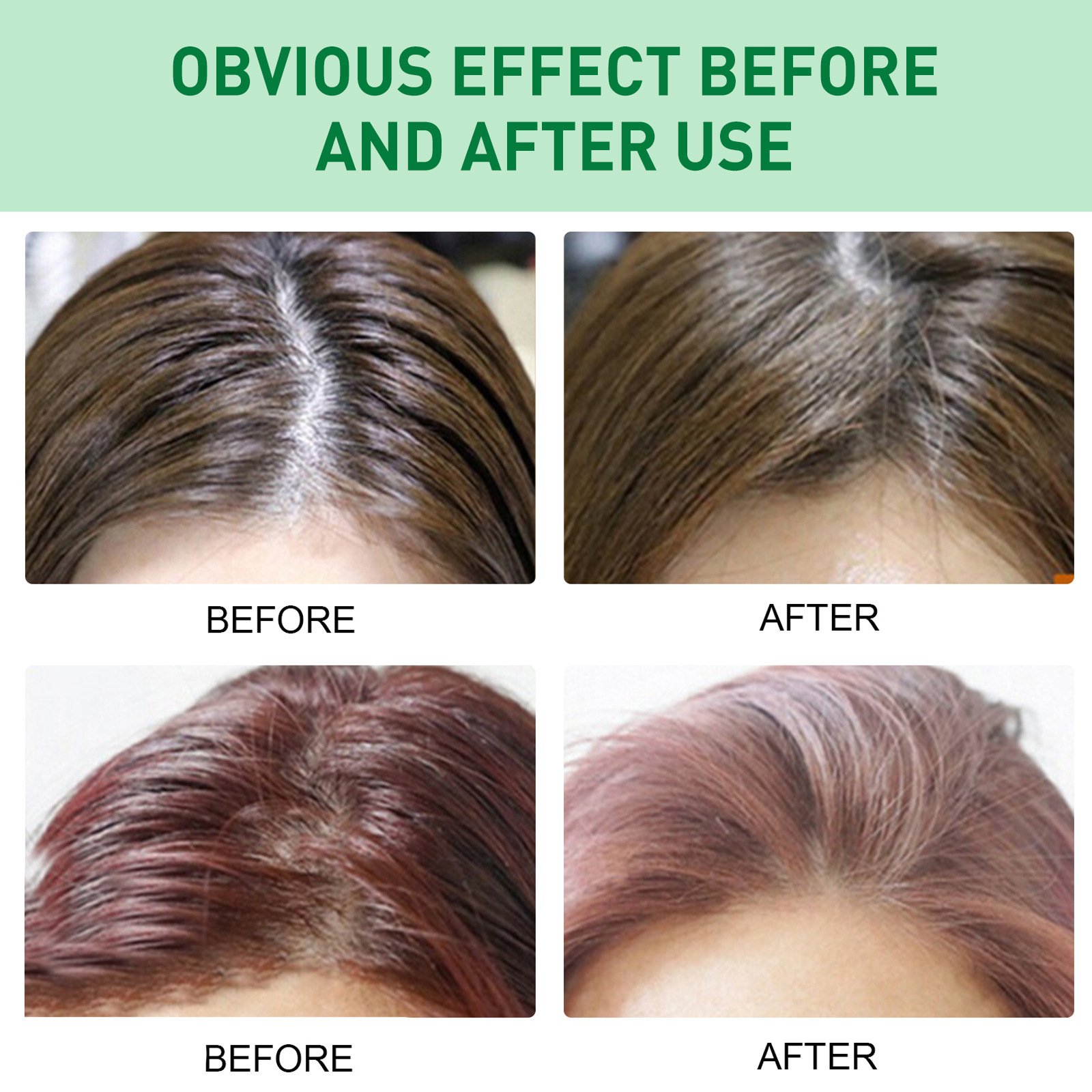Wholesale Custom Travel No Washing Organic Hair Private Label Dry Shampoo Spray