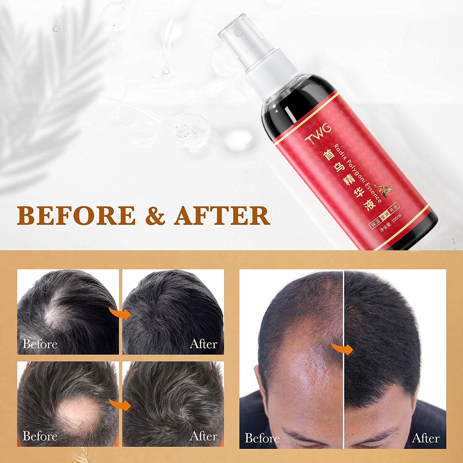 TWG Hair Regrowth Serum Hair Strengthening Alopecia Treatment For Men And Women Polygonum Herb Hair Growth Serum