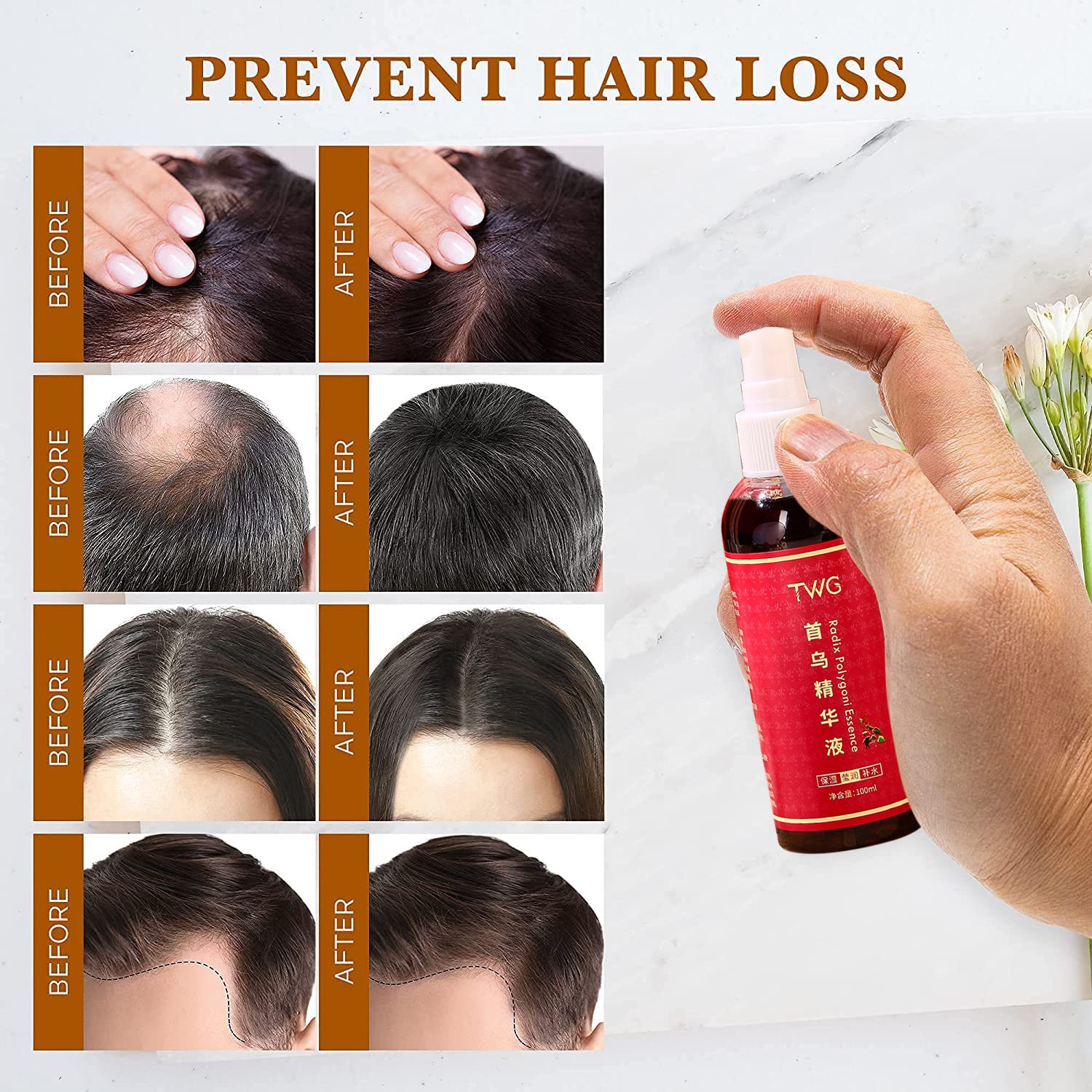 TWG Hair Regrowth Serum Hair Strengthening Alopecia Treatment For Men And Women Polygonum Herb Hair Growth Serum