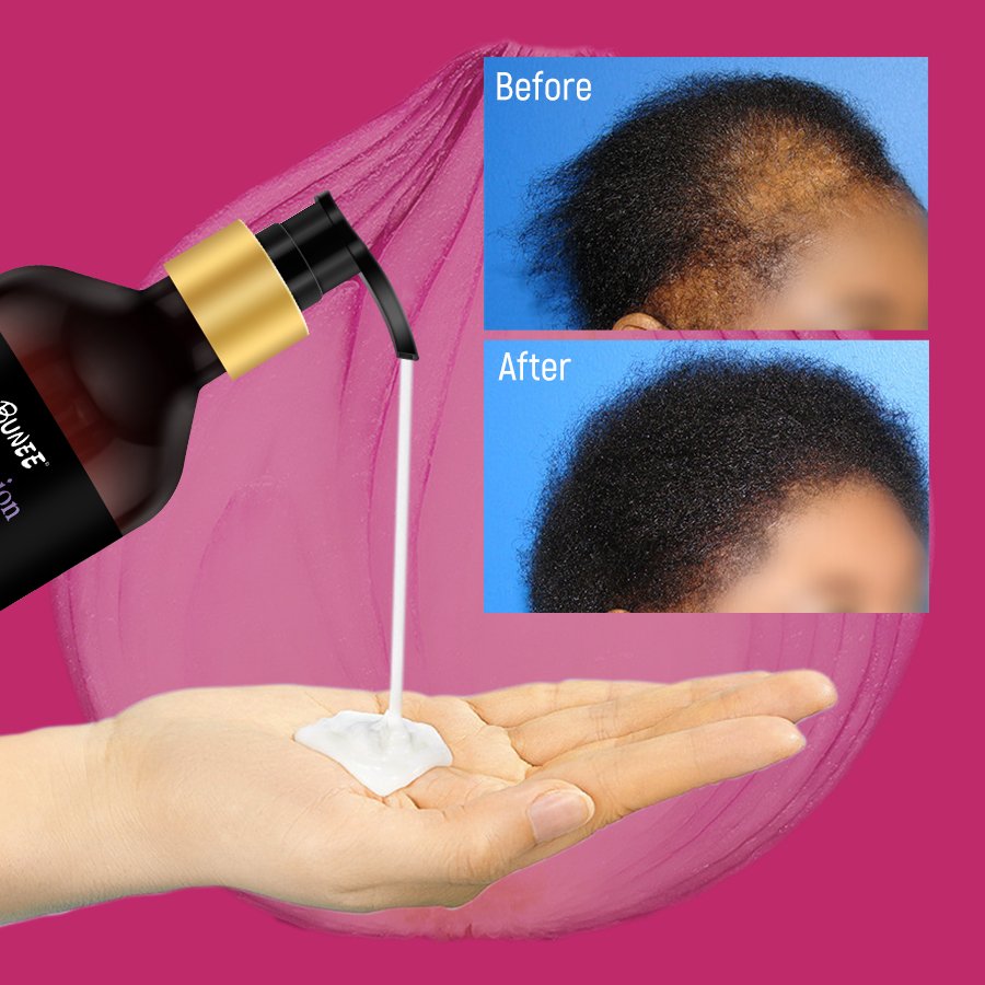 New Product Customization Natural essences Anti Hair Loss Thinning Hair Growth Shampoo Onion Black Seed Oil Shampoo