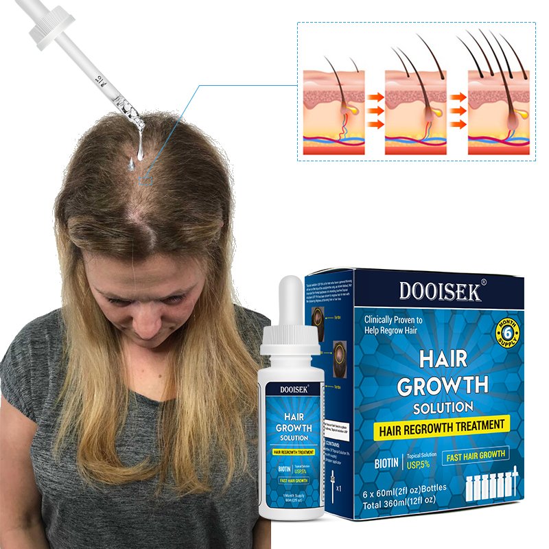 Chinese 60ML*6 Bottle promote hair regrowth anti loss herbal biotin hair growth serum tonic for private label