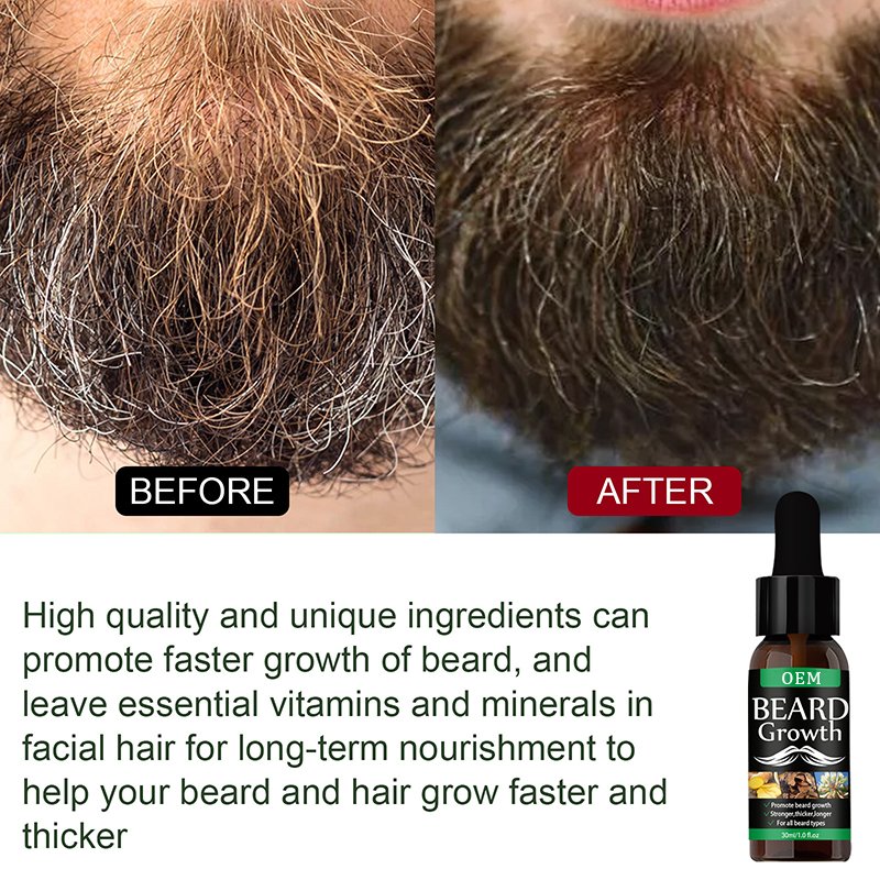 OEM Wholesale Organic ingredients Moustache Styling Softens Grooming Beard Growth Oil Beard Length Enhancer Regrowth Oil OEM