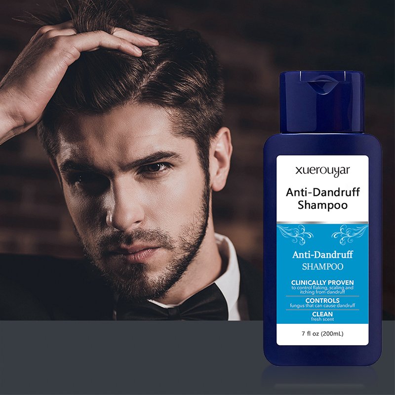 Private Label sulphate free organic profesional Plant Extract Herbal Hair for Itchy Dry Scalp Oily Hair Anti-Dandruff Shampoo