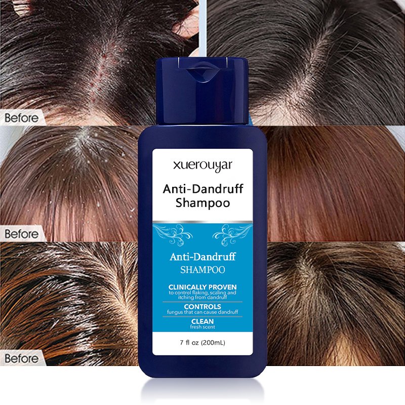 Private Label sulphate free organic profesional Plant Extract Herbal Hair for Itchy Dry Scalp Oily Hair Anti-Dandruff Shampoo