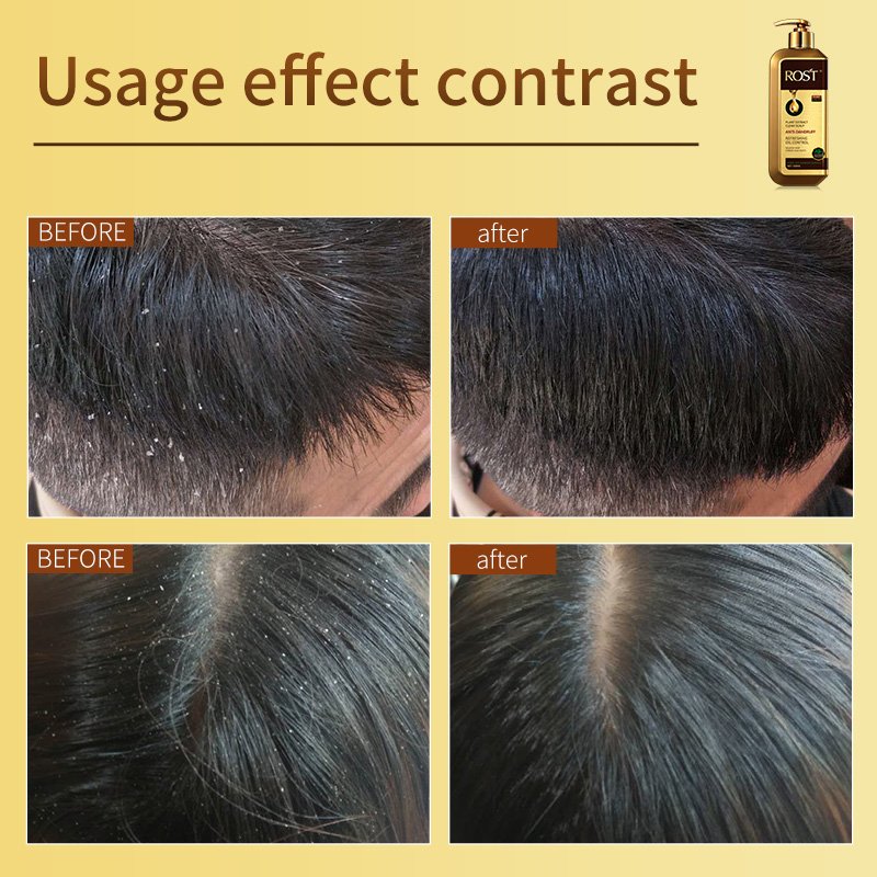 Private Label Anti Dandruff Herbal Extract Oil Control Moisturizing Nourishing Refreshing Scalp Deep Cleansing Shampoo Product