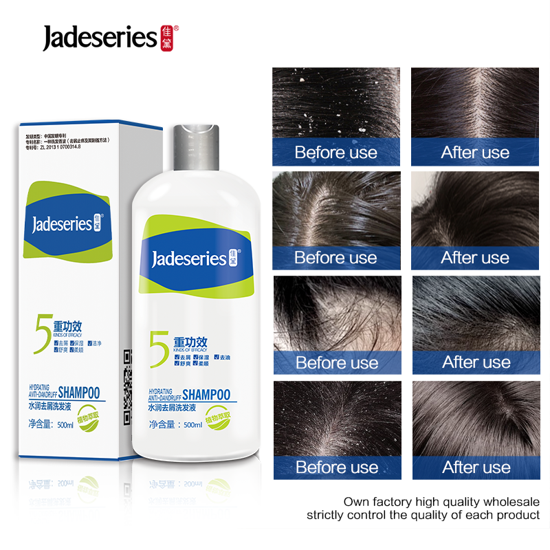 Hot sale of own brand shampoo, the best natural organic shampoo brand moisturizing anti-dandruff shampoo