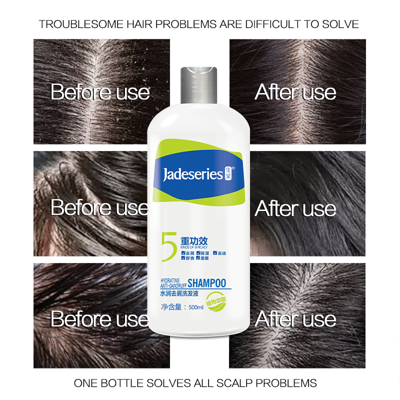 Hot sale of own brand shampoo, the best natural organic shampoo brand moisturizing anti-dandruff shampoo