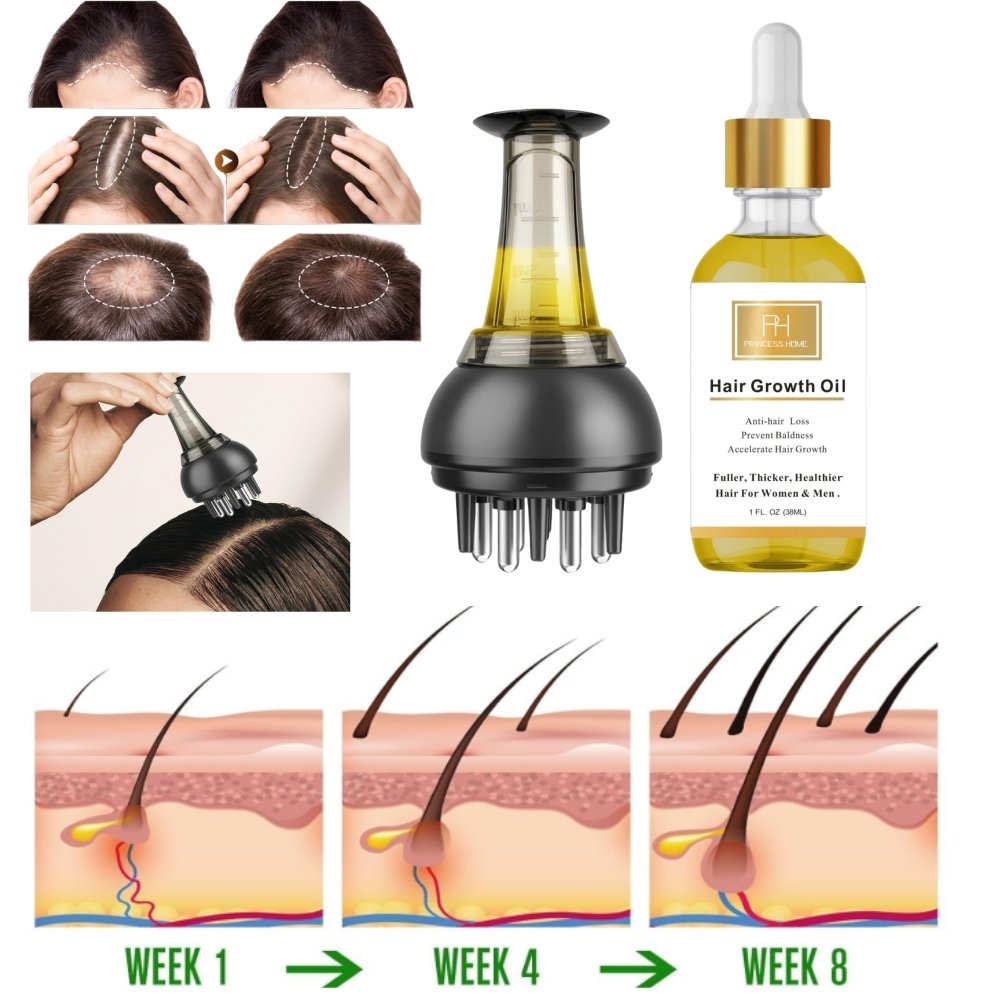 Private Label Biotin Rosemary Fast Hair Growth Oil Organics Mint Scalp & Hair Loss Treatment Strengthening Hair Essential Oil