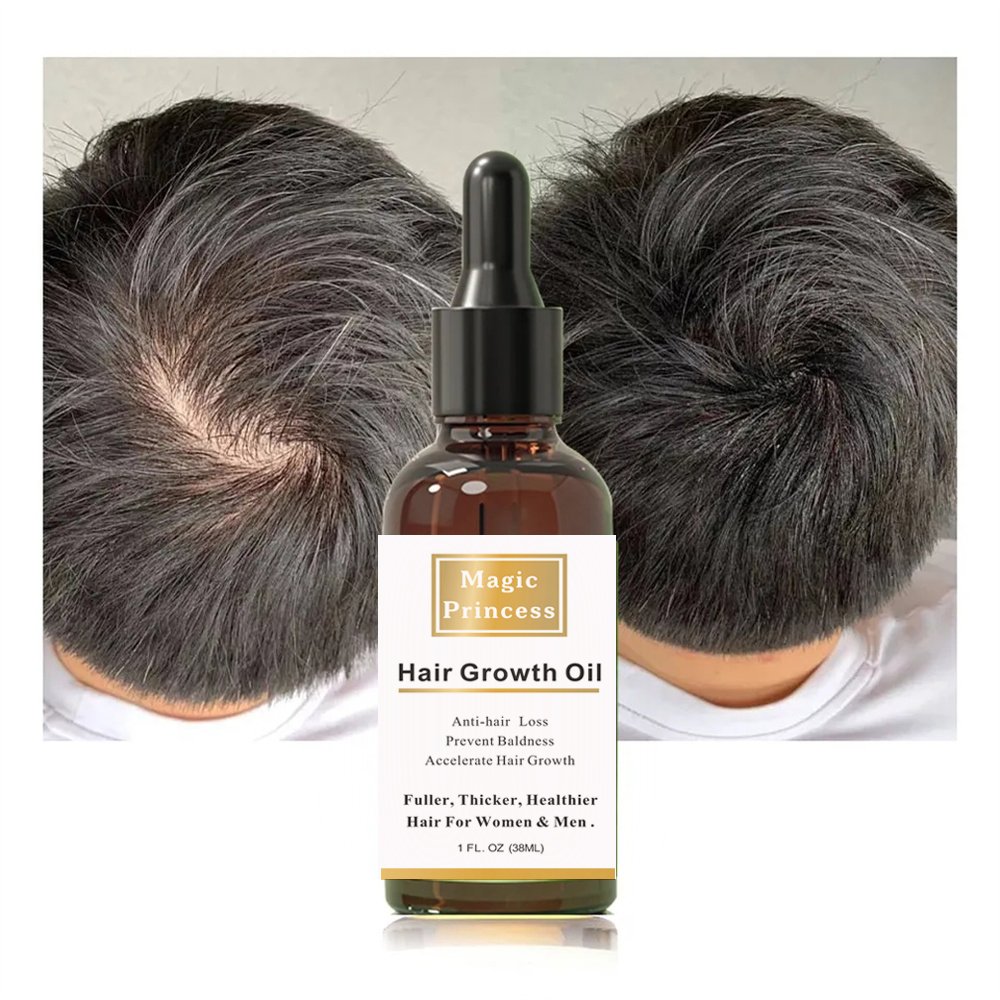 Private Label Biotin Rosemary Fast Hair Growth Oil Organics Mint Scalp & Hair Loss Treatment Strengthening Hair Essential Oil