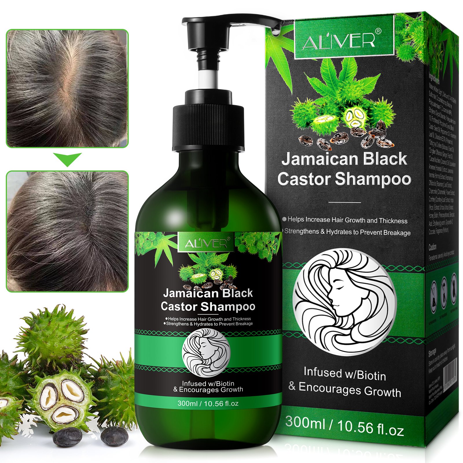 ALIVER private label sulfate free shampoo,hair care prevent breakage natural organic black castor oil hair growth shampoo