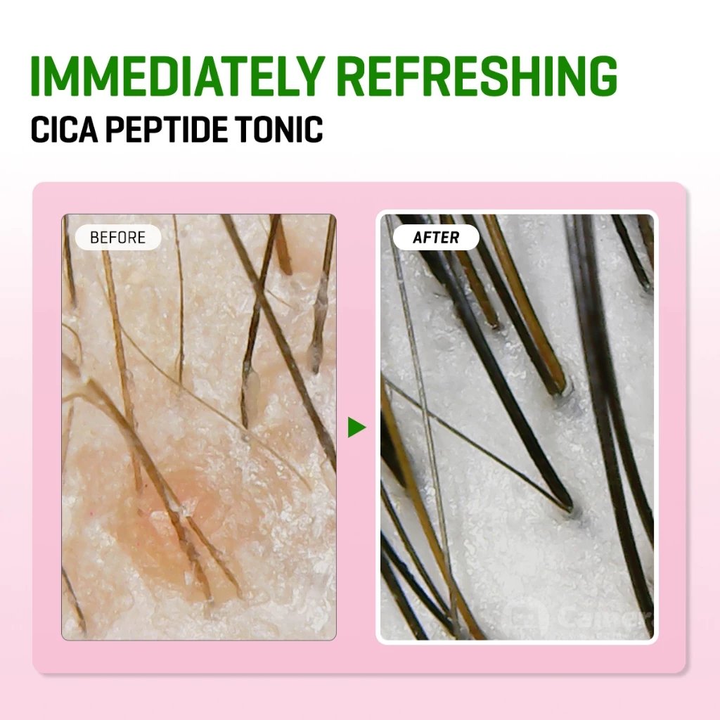 Wholesale Herbal Extract Formula 150ml Hair Lotion Anti Hair Loss Hair Growth Tonic