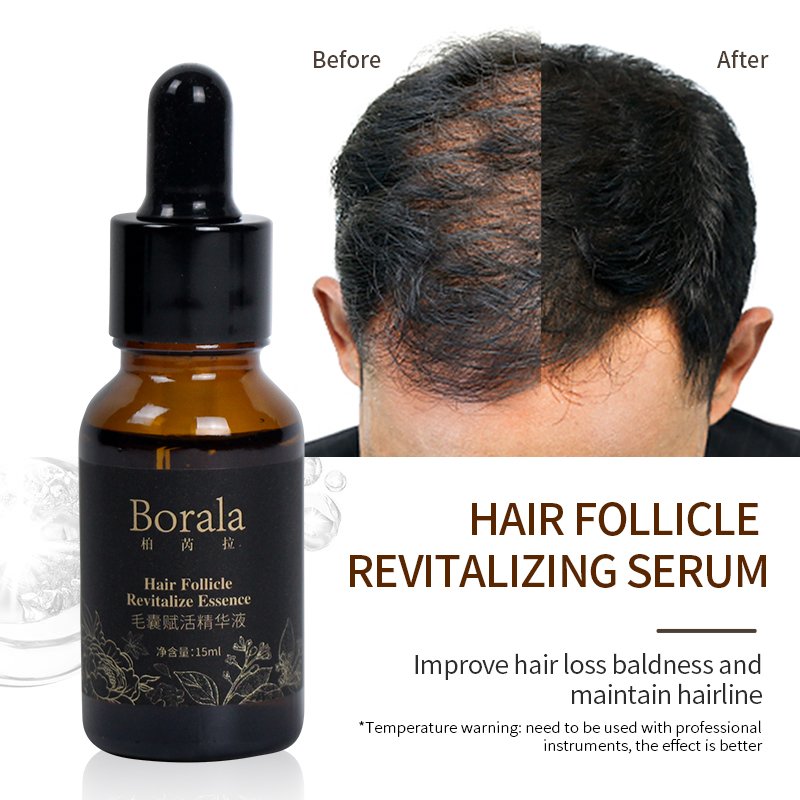 Hair Regrowth Treatments Anti loss serum hair growth oil alopecia hair loss treatment products organic regrowth oil