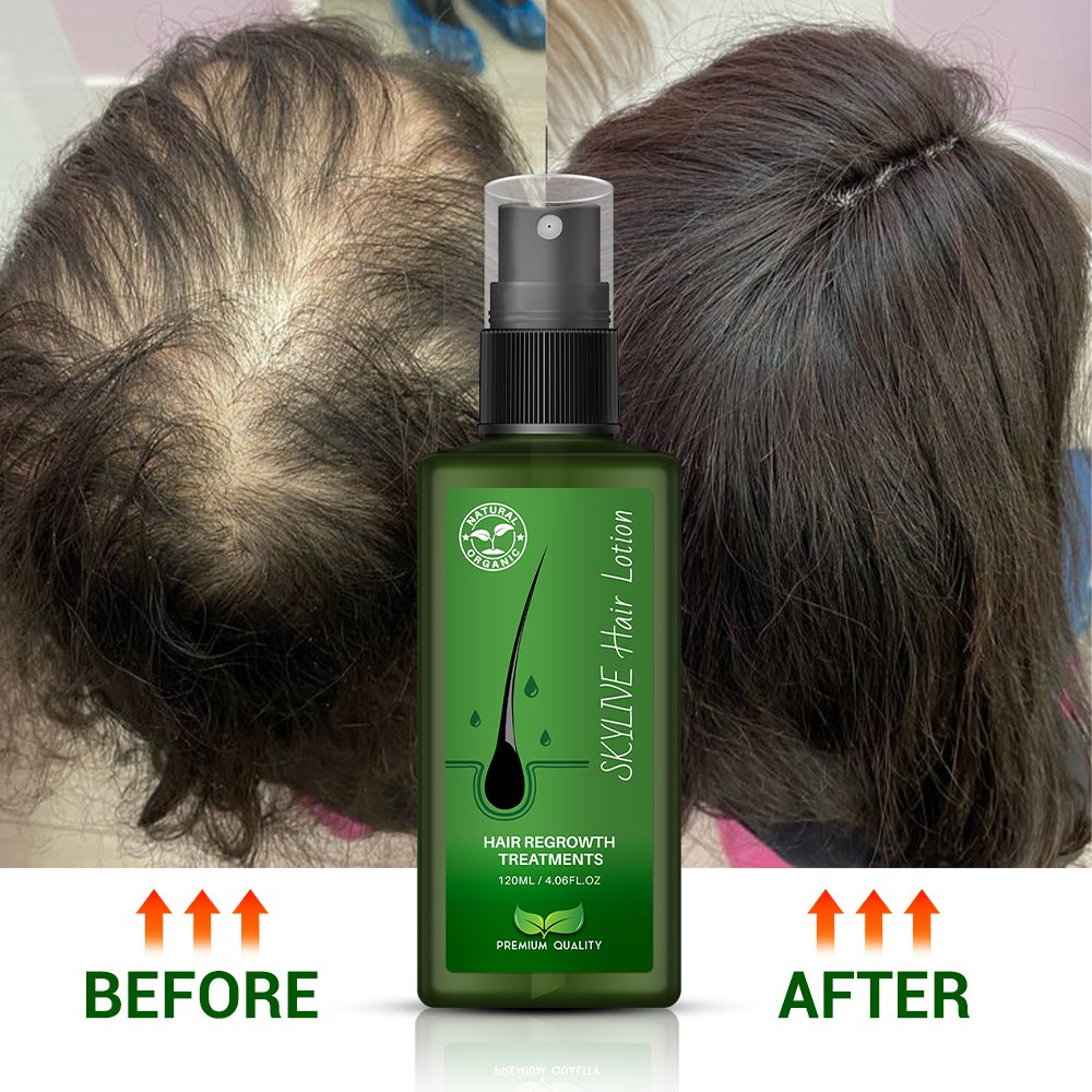 Customized Thailand New Green Bottle Hair Growth Serum Hair Lotion Hair Regrowth Treatment Serum 120ml huile de busserol