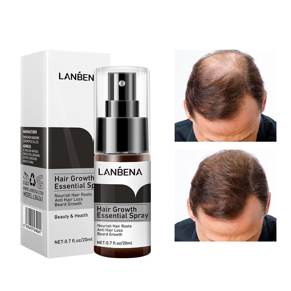 LANBEN 20ml topical Solution Scalp Biotin Collagen Fast Result Hair Regrowth Tonics Hair Growth Serum Oil