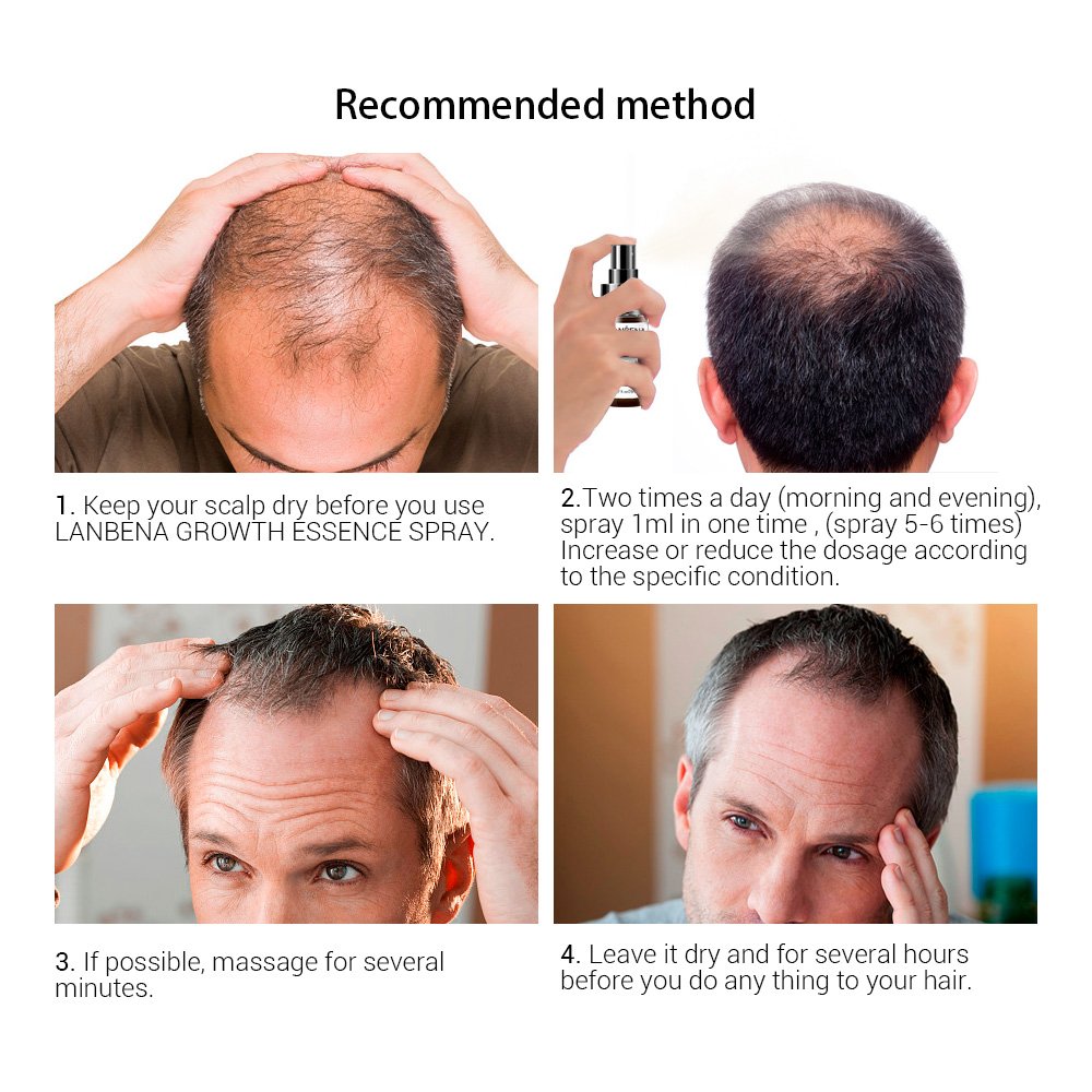LANBEN 20ml topical Solution Scalp Biotin Collagen Fast Result Hair Regrowth Tonics Hair Growth Serum Oil