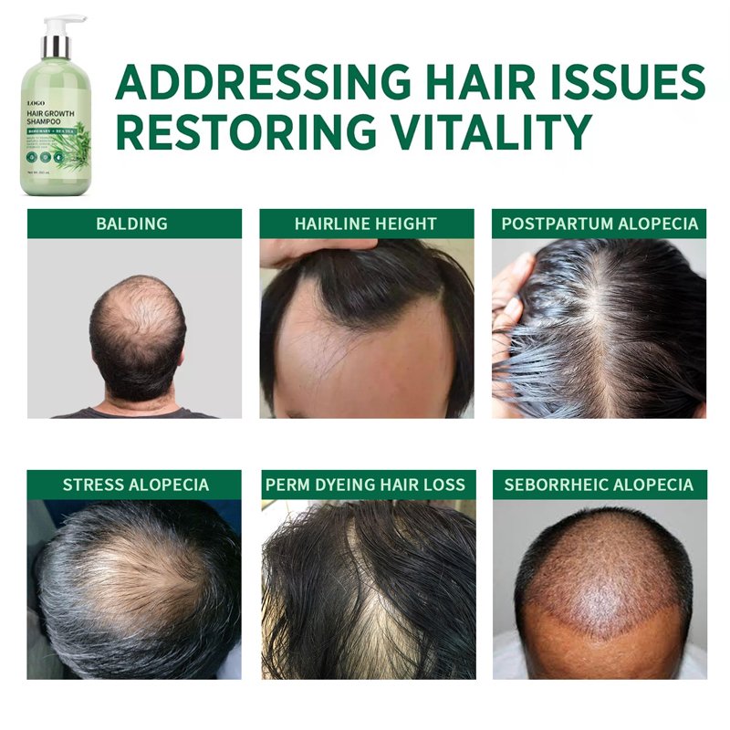 Personal custom to promote hair fluff natural growth retain long-lasting scented rosemary mint shampoo