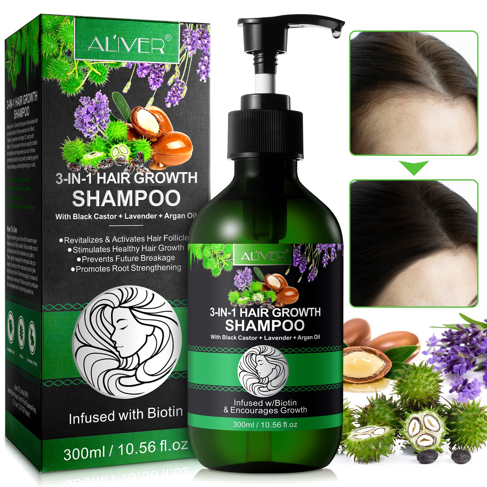 ALIVER private label activates hair follicles 300ml biotin jamaican black castor lavender argan oil shampoo for hair growth