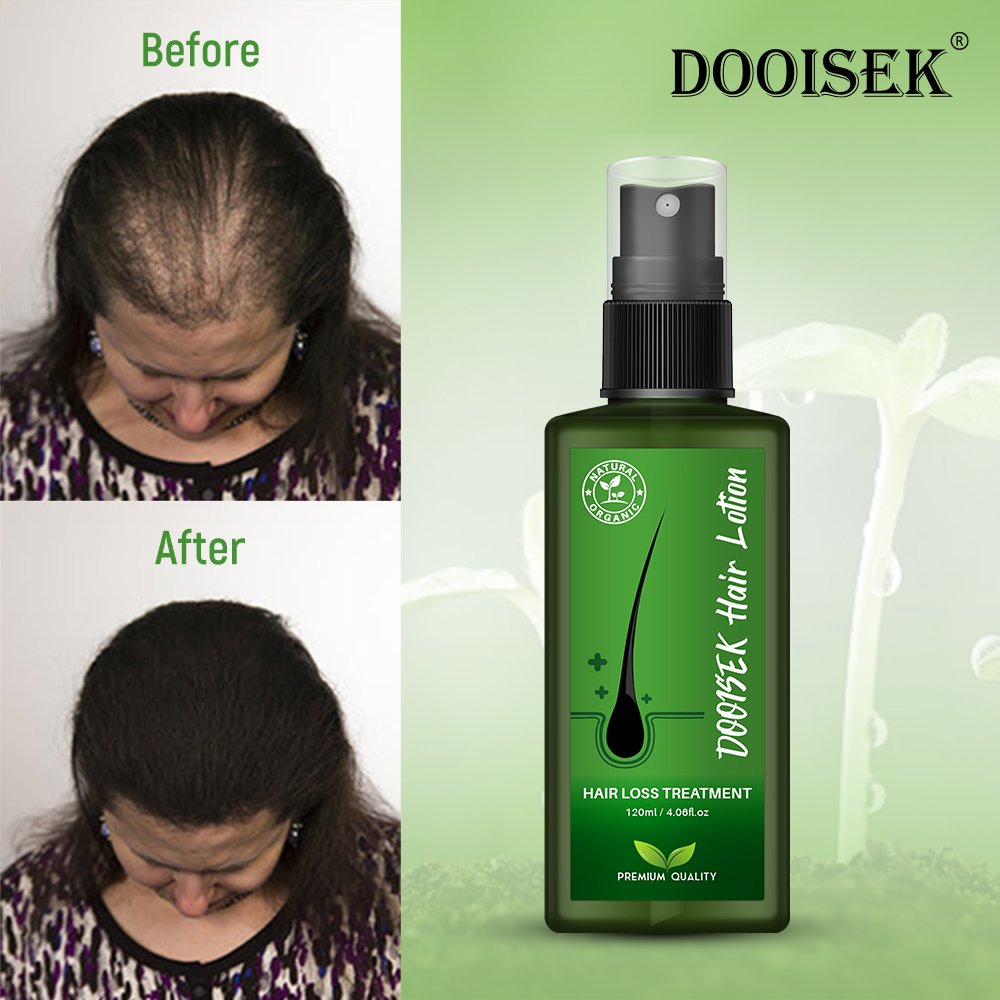 private label natural fast hair growth serum for african alopeciae regrowth oil for black women product indian