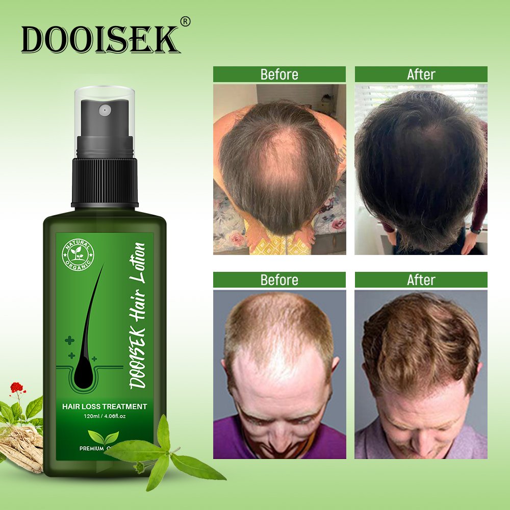 private label natural fast hair growth serum for african alopeciae regrowth oil for black women product indian