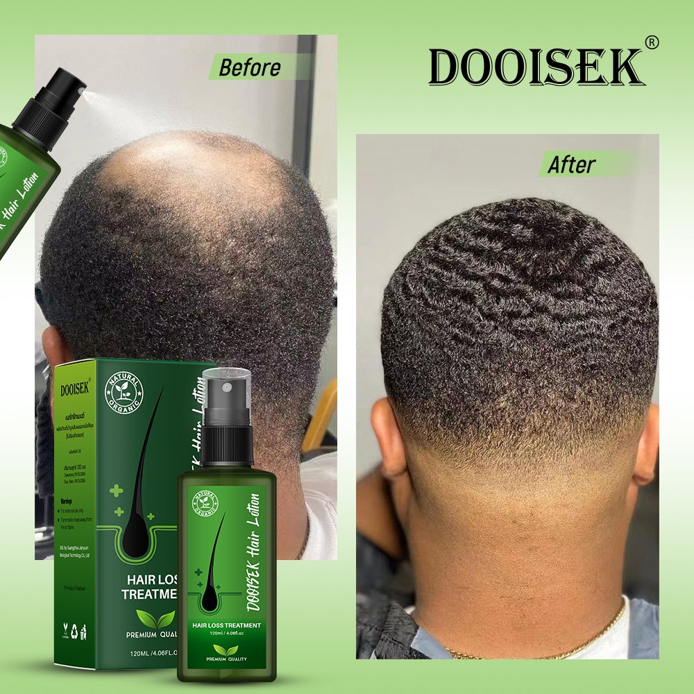 private label natural fast hair growth serum for african alopeciae regrowth oil for black women product indian