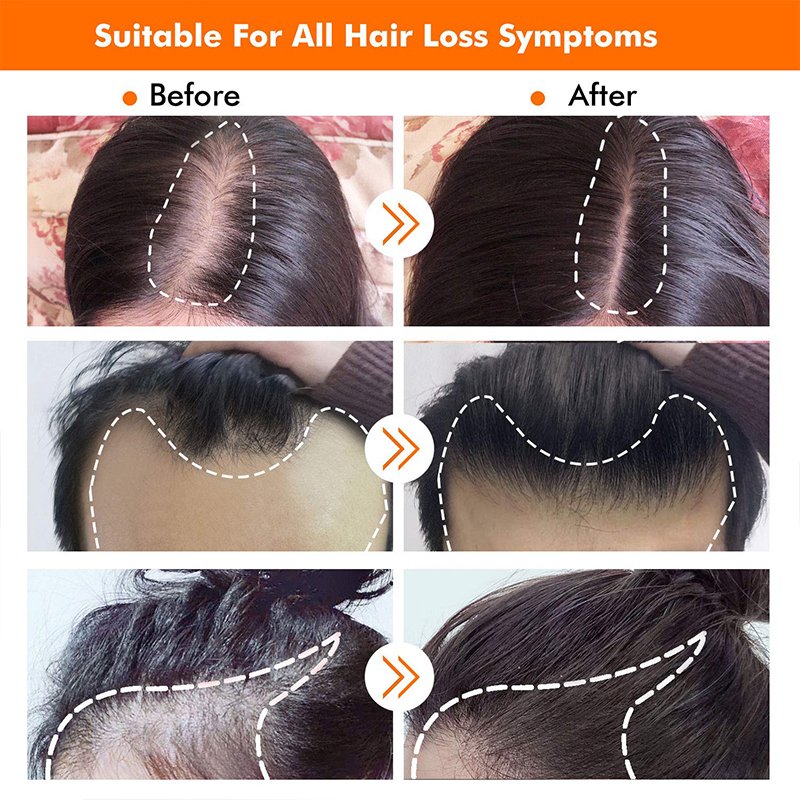 Private label argan biotin serum strengthen hair roots anti-hair loss solution hair growth kit