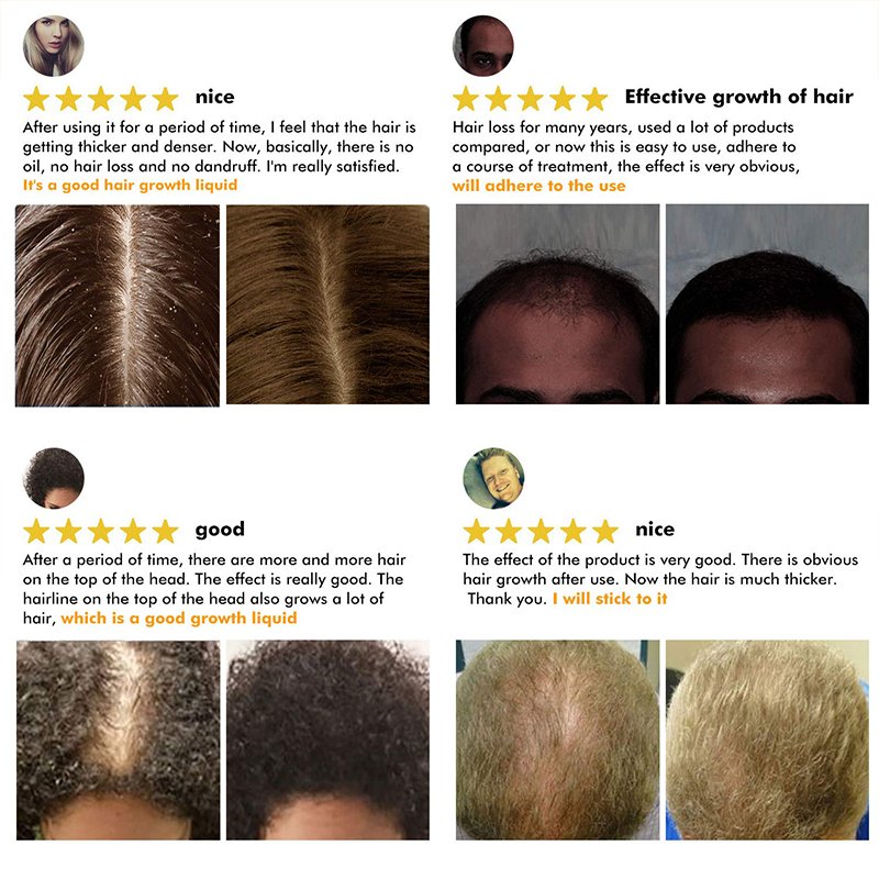 Private label argan biotin serum strengthen hair roots anti-hair loss solution hair growth kit
