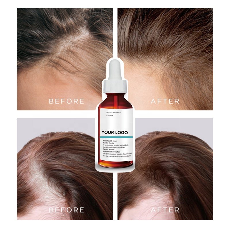 Wholesale Direct Sales Hair Tonic Packaging Best Hair Growth Serum Manufacturers