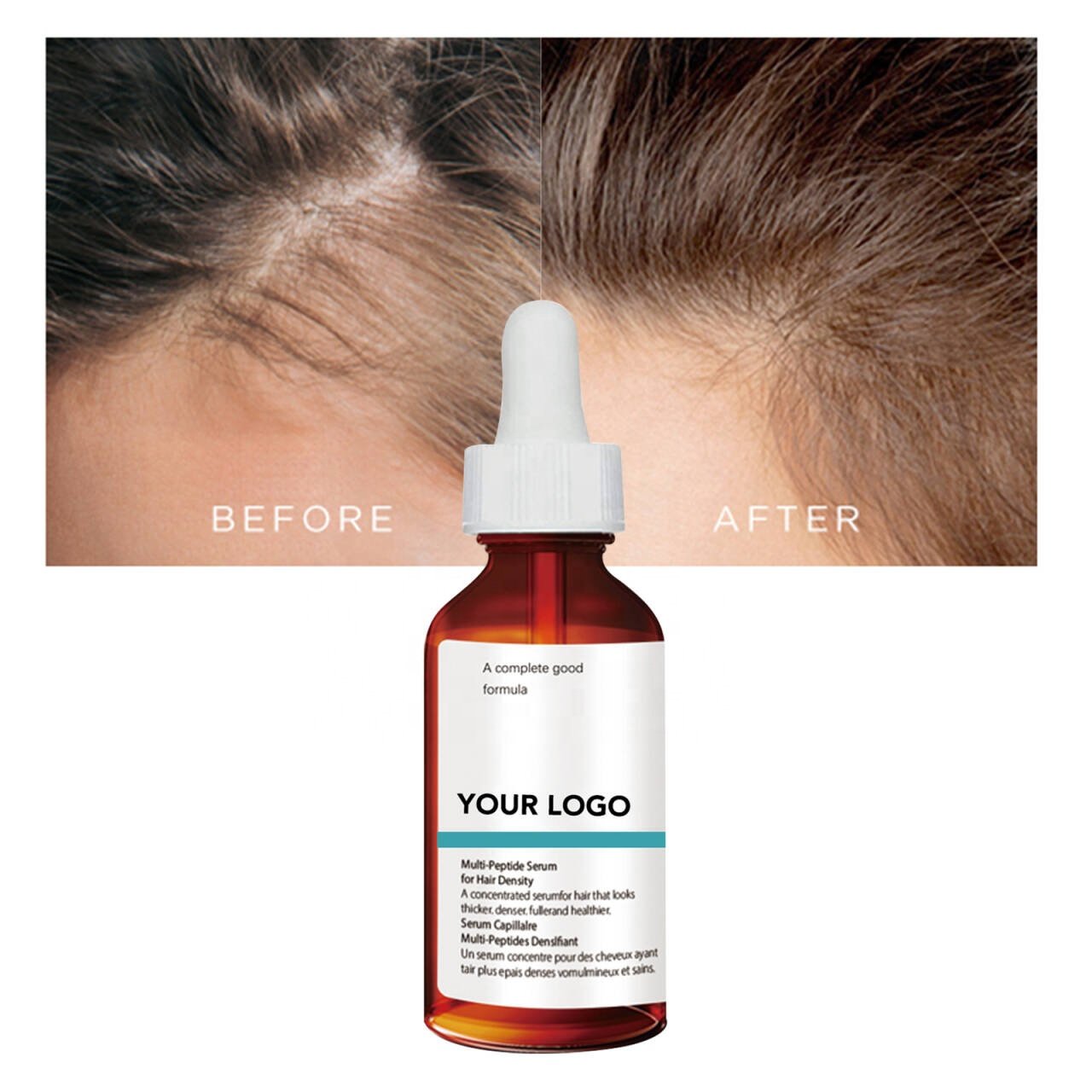 Wholesale Direct Sales Hair Tonic Packaging Best Hair Growth Serum Manufacturers