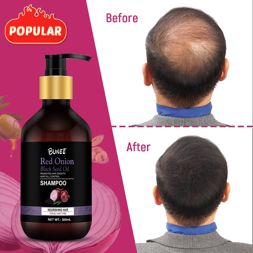 BUNEE Private Label onion Plant Extract Hair Growth Anti Hair Loss hair Shampoo