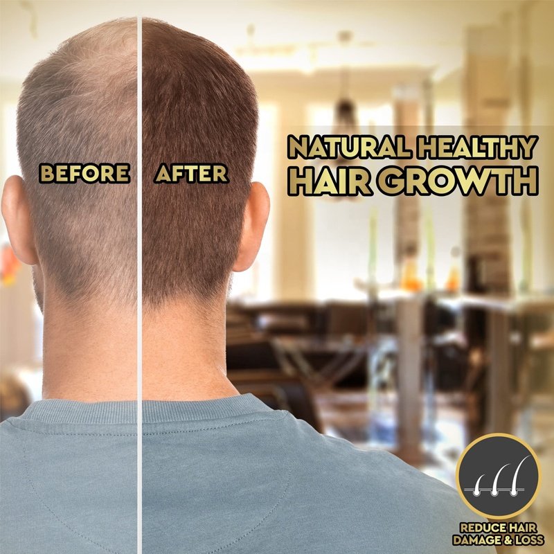 Low Moq Hair Growth Serum Hair Care Ghk-cu Blue Copper Peptide Hair Loss Treatment