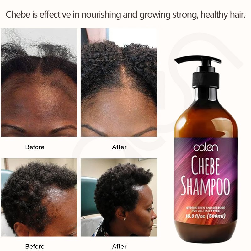 Oalen Private Label Nourishing Prevent Hair Loss Moisturizing Scalp Chebe Shampoo