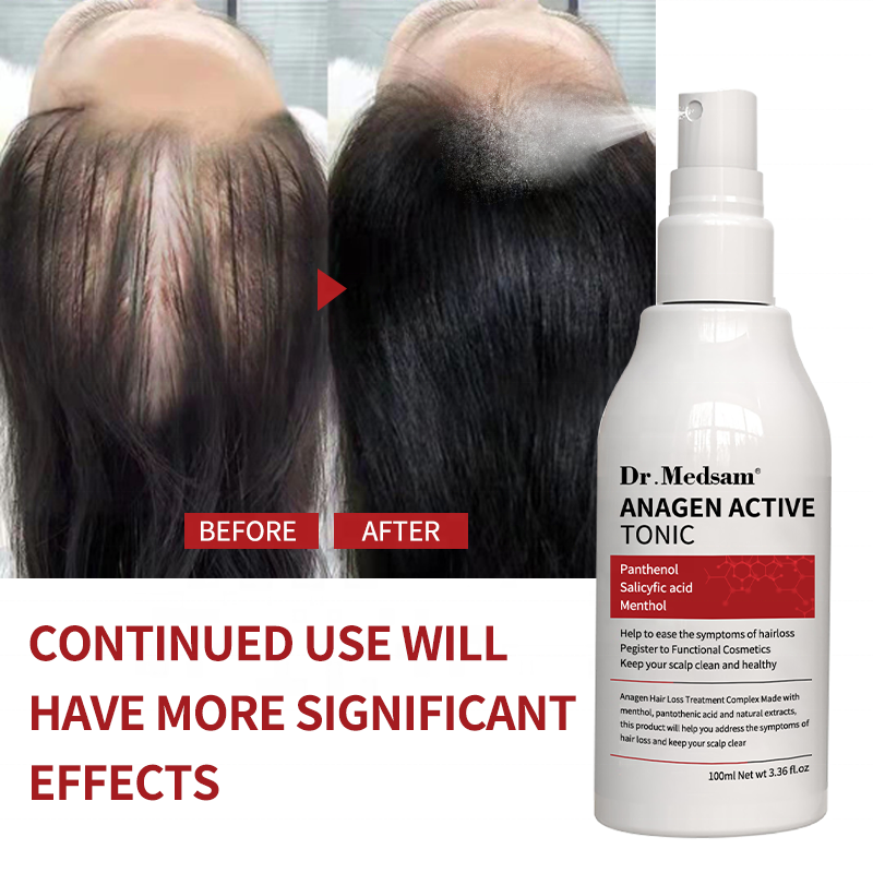 Treatment Hair Growth Anti Hair Loss Spray Repair Nourish Scalp Consolidate Hair Roots