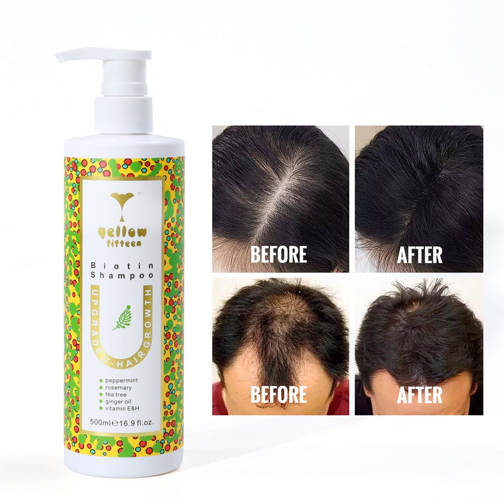Rosemary Mint Strengthening Hair Growth Biotin Shampoo Strengthen Weak and Brittle Hair 250ml
