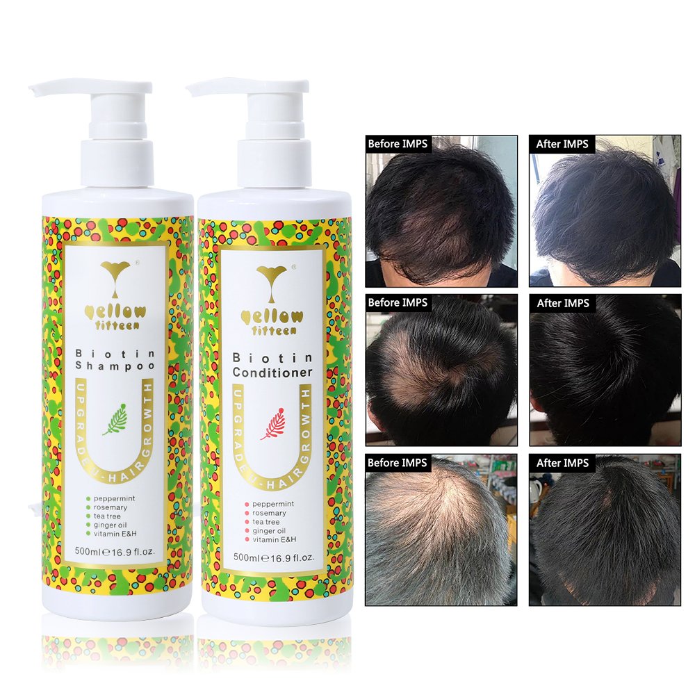 Private Label Nourishing Hair-Loss Prevention Shampoo Conditioner Organic Castor Oil Batana Hair Growth Serum Oil Hair Care Set
