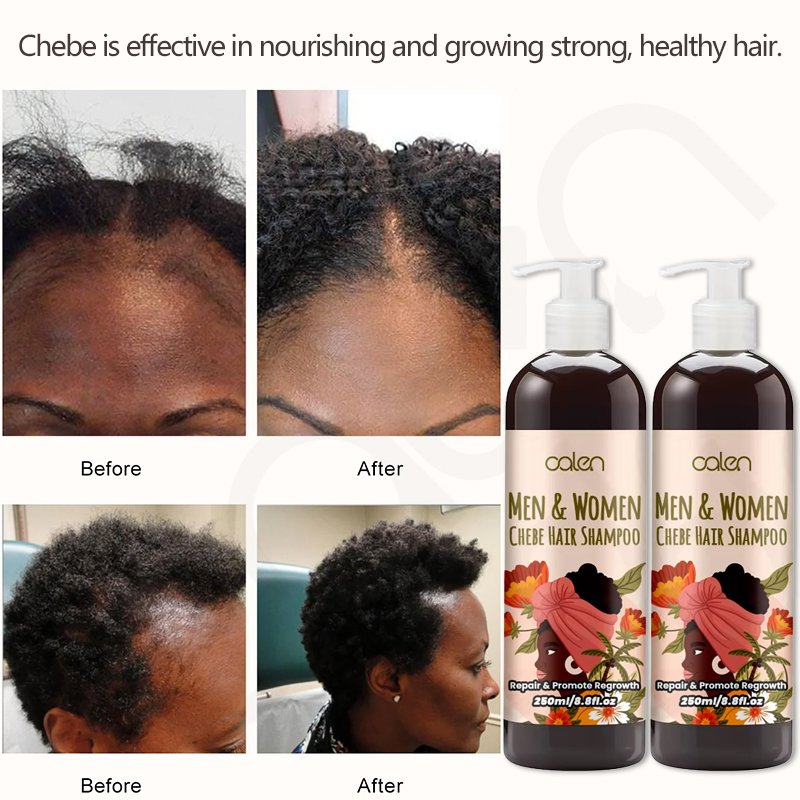 Oalen Customs Logo 250ML Chebe Hair Shampoo Repair Damaged Hair Anti-Dandruff Moisture Hair Growth Shampoo