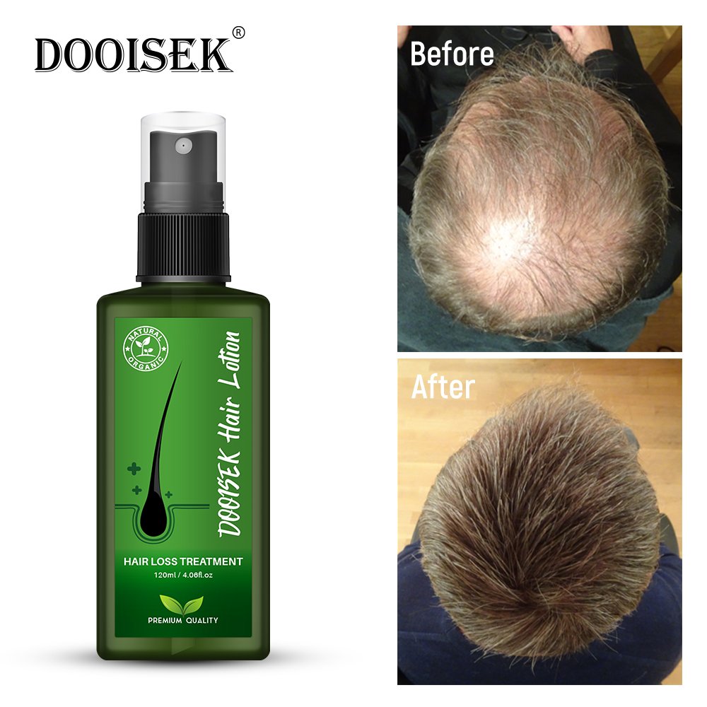 Hair growth scalp serum oil spray anti hair loss treatment regrowth tonics 120ml new DOOISEK hair lotion thailand