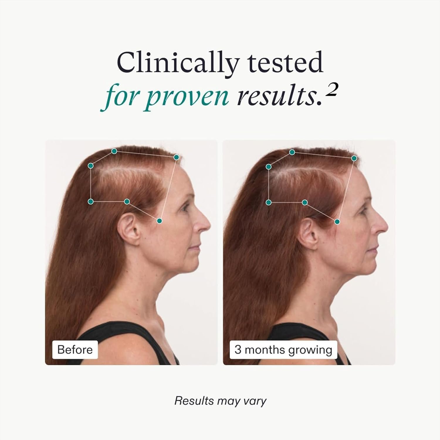 Hair Fall and Bald The Best Fast Improve Women's Alopecia Vitamins Hair Growth Regrowth Supplement Tonics Products Treatments