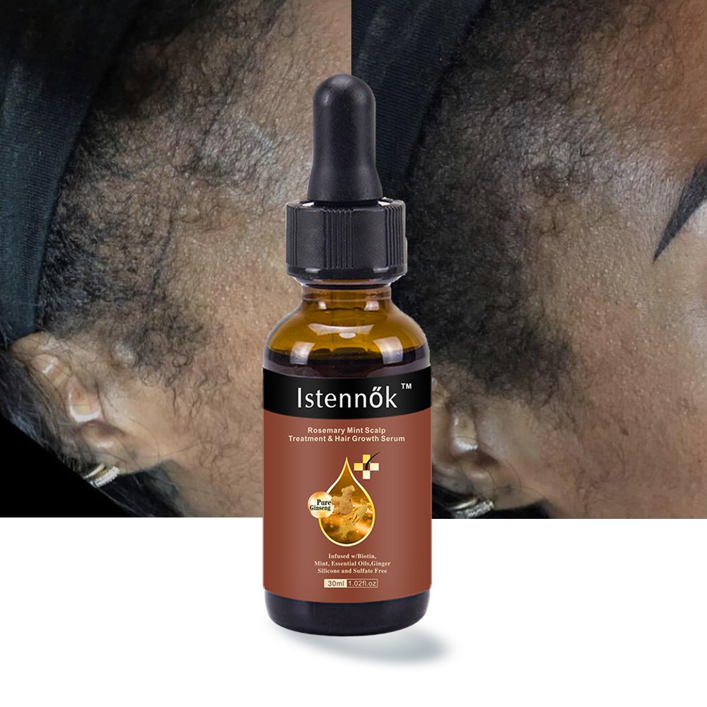 ISK Organic Lavender Rosemary Fast Hair Growth Oil For African Alopecia Regrowth Mint Serum Hair Loss Products