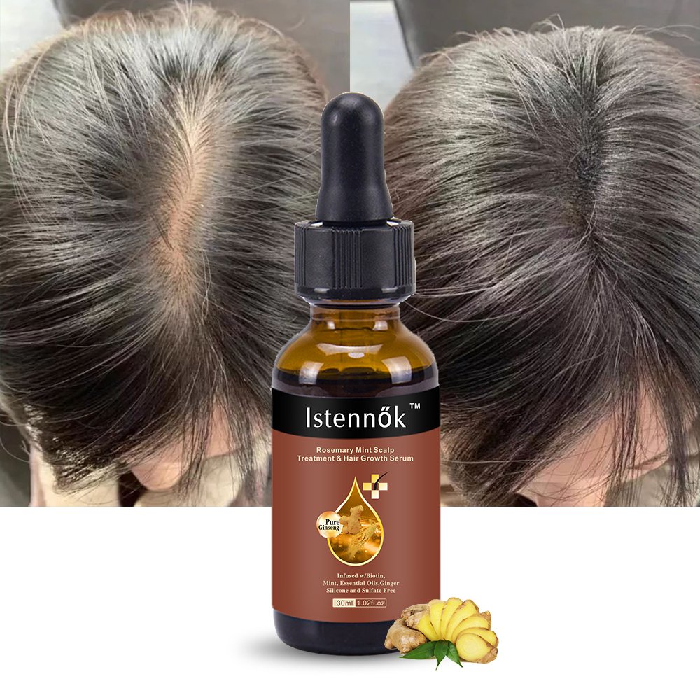 ISK Organic Lavender Rosemary Fast Hair Growth Oil For African Alopecia Regrowth Mint Serum Hair Loss Products