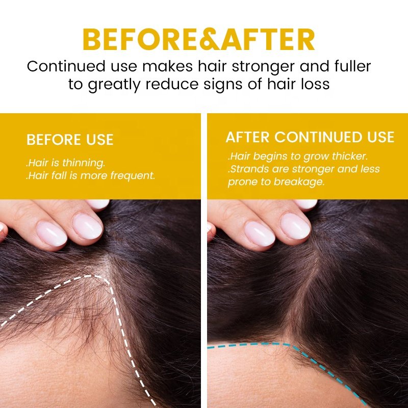Low Price Ekber Natural Biotin Argan Oil Nourishing Spilt-end Problem Hair Growth Shampoo Conditioner Hair Care Products Bulk